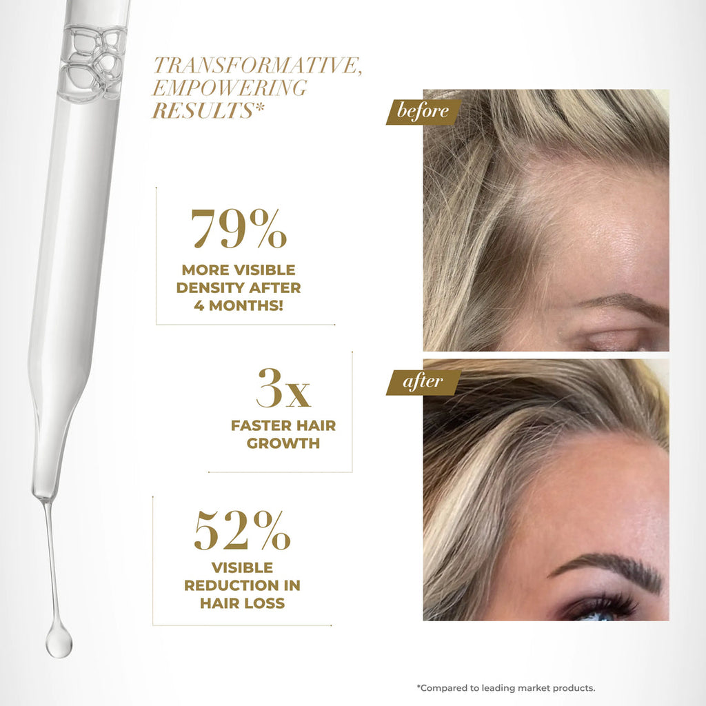 Scalp Serum - Signature Extensions, Delray Beach FL